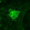 Endothelial cells