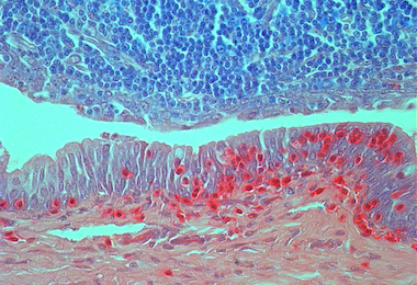 Allergic conjunctivitis models