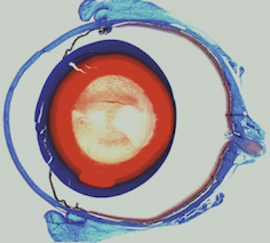 Corneal wound healing model