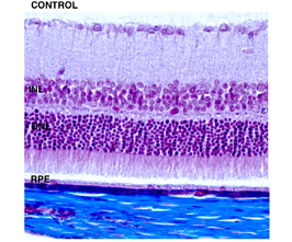 Retinal degeneration control