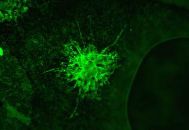 Angiogenesis & Permeability Models