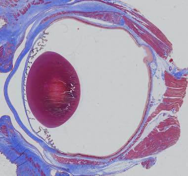 Ocular Inflammation Models